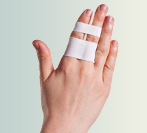 Finger Fracture