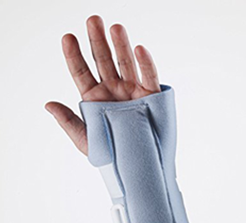 Wrist Sprains